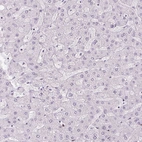 Immunohistochemical staining of human liver shows no nuclear positivity in hepatocytes as expected.