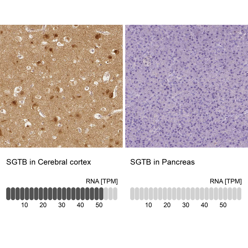 Anti-SGTB Antibody