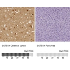 Anti-SGTB Antibody