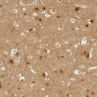 Immunohistochemical staining of human cerebral cortex shows high expression.