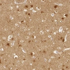 Immunohistochemical staining of human cerebral cortex shows high expression.