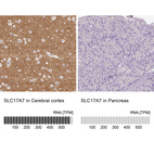 Anti-SLC17A7 Antibody