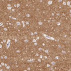 Anti-SLC17A7 Antibody