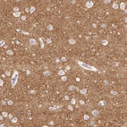 Immunohistochemical staining of human cerebral cortex shows moderate cytoplasmic positivity in neuropil.