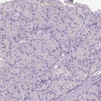 Immunohistochemical staining of human pancreas shows no positivity in exocrine glandular cells as expected.