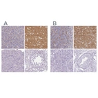 Immunohistochemical staining of human cerebellum, cerebral cortex, pancreas and testis using Anti-VGLUT1 antibody HPA063679 (A) shows similar protein distribution across tissues to independent antibody HPA050458 (B).