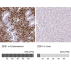 Immunohistochemistry analysis in human endometrium and liver tissues using AMAb90510 antibody. Corresponding ZEB1 RNA-seq data are presented for the same tissues.