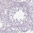 Immunohistochemical staining of human testis shows no positivity in cells in seminiferous ducts as expected.