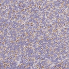 Immunohistochemical staining of human cerebellum shows moderate cytoplasmic positivity in cells in granular layer.