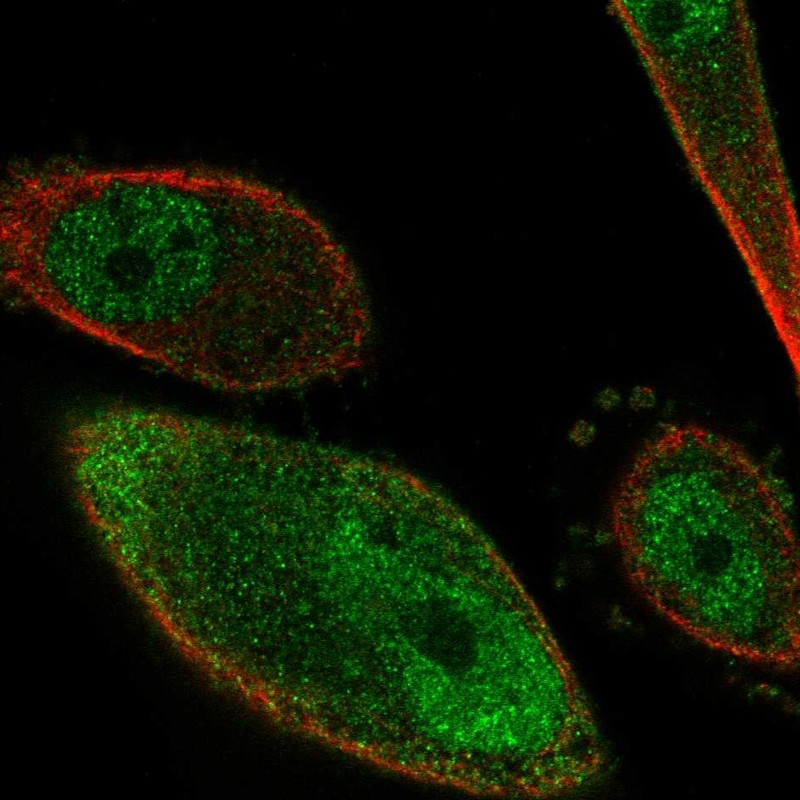 Anti-PKIG Antibody