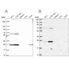 Western blot analysis using Anti-TFAM antibody HPA063684 (A) shows similar pattern to independent antibody HPA040648 (B).