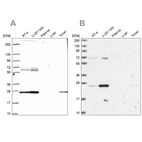 Western blot analysis using Anti-TFAM antibody HPA063684 (A) shows similar pattern to independent antibody HPA040648 (B).