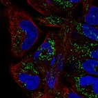 Immunofluorescent staining of human cell line RH-30 shows localization to mitochondria.