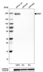 Western blot analysis in Rh30 cells transfected with control siRNA, target specific siRNA probe #1 and #2, using Anti-ZEB1 antibody. Remaining relative intensity is presented. Loading control: Anti-GAPDH.
