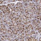 Anti-YIPF3 Antibody