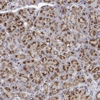 Anti-YIPF3 Antibody