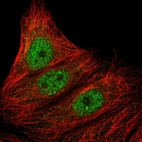 Anti-ARMC5 Antibody