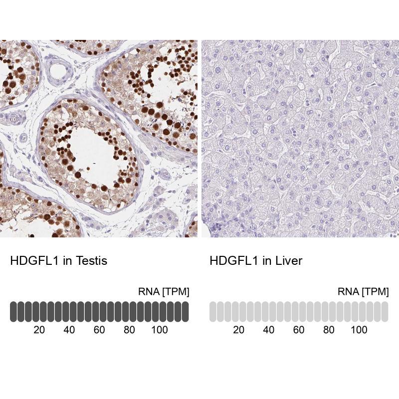 Anti-HDGFL1 Antibody