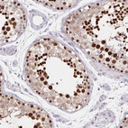 Immunohistochemical staining of human testis shows strong nuclear positivity in spermatids.