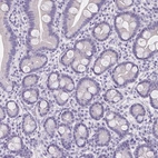 Immunohistochemical staining of human small intestine shows no positivity in glandular cells as expected.