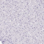 Immunohistochemical staining of human liver shows no positivity in hepatocytes as expected.