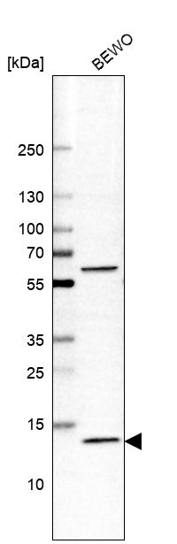 Anti-GLRX5 Antibody