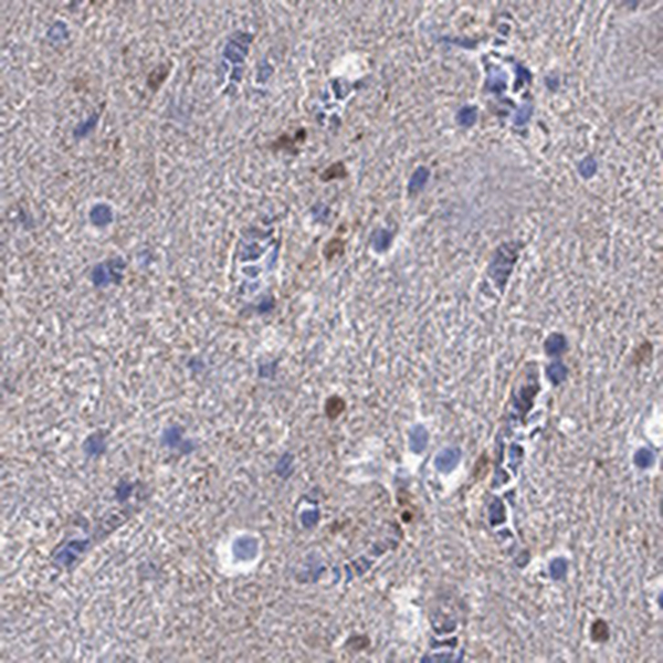 Anti-CAMKK2 Antibody
