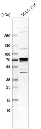 Western blot analysis in human cell line SCLC-21H.