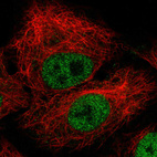 Anti-ZEB1 Antibody