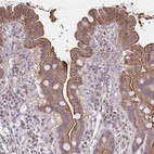 Immunohistochemical staining of human small intestine shows moderate positivity in apical membrane in glandular cells.