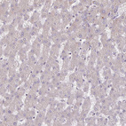 Immunohistochemical staining of human liver shows no positivity in hepatocytes as expected.