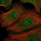Immunofluorescent staining of human cell line MCF7 shows localization to nucleoplasm & plasma membrane.