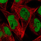 Immunofluorescence staining in RH30 cell line with Anti-ZEB1 monoclonal antibody, showing nuclear (without nucleoli) staining in green. Microtubule probes are visualized in red (where available).