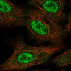 Immunofluorescent staining of human cell line A549 shows localization to nucleoplasm & cytosol.