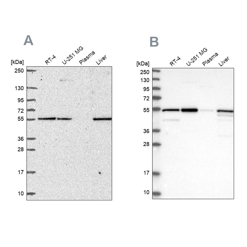 Anti-PMPCA Antibody