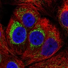 Immunofluorescent staining of human cell line MCF7 shows localization to mitochondria.