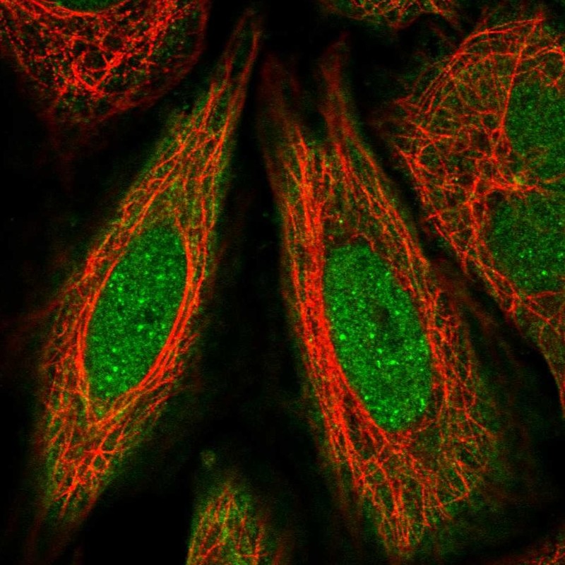 Anti-FANCD2 Antibody