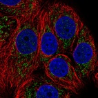 Immunofluorescent staining of human cell line MCF7 shows localization to mitochondria.