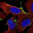Immunofluorescent staining of human cell line U-2 OS shows localization to vesicles.