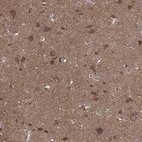 Anti-BMERB1 Antibody