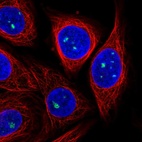 Anti-ZDHHC14 Antibody