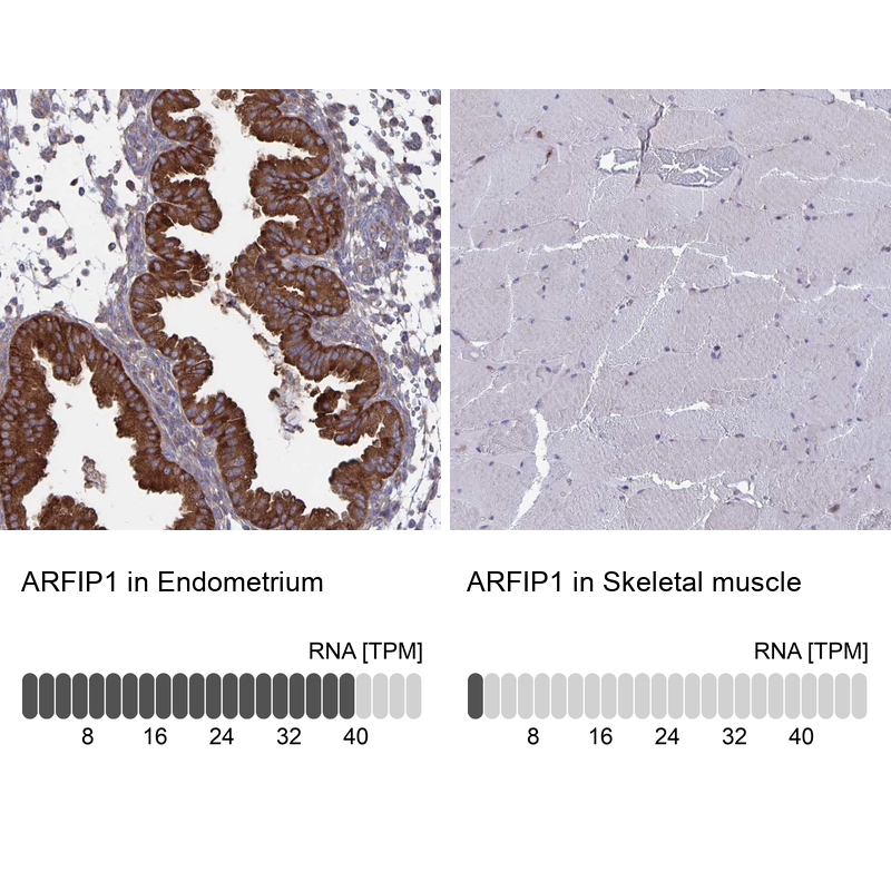 Anti-ARFIP1 Antibody