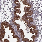 Immunohistochemical staining of human endometrium shows high expression.