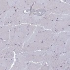 Immunohistochemical staining of human skeletal muscle shows low expression as expected.