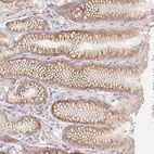 Anti-ACVR1B Antibody