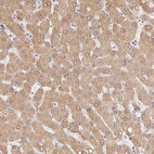 Immunohistochemical staining of human liver shows moderate cytoplasmic positivity in hepatocytes.