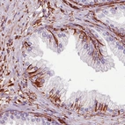 Immunohistochemical staining of human prostate shows strong immunoreactivity in the connective tissue.
