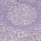 Anti-ACVR1B Antibody