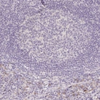 Immunohistochemical staining of human lymph node shows no positivity in germinal center cells as expected.