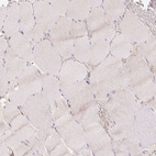Immunohistochemical staining of human skeletal muscle shows no positivity in myocytes as expected.